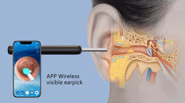 Smart Visual Ear Otoscope Endoscope Wax Removal Tool (3)